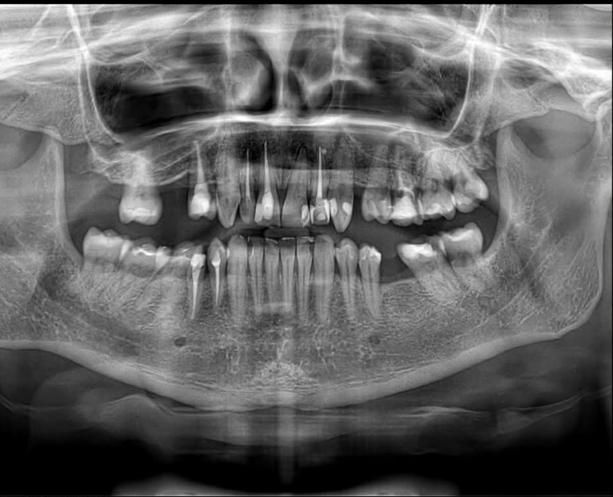 Panoraminė nuotrauka